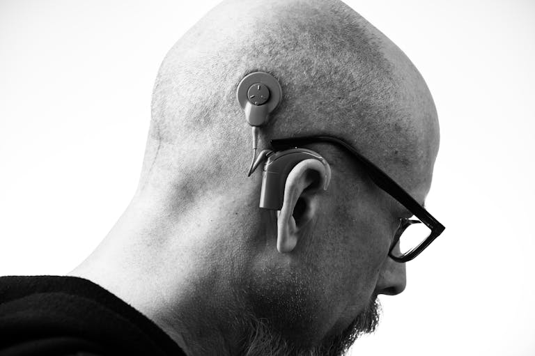 Grayscale Photo of a Man with a Cochlear implant hearing device